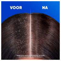 Head & Shoulders Shampoo – Classic Clean Antiroos 400 ml Head & Shoulders